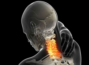 頚部の痛み